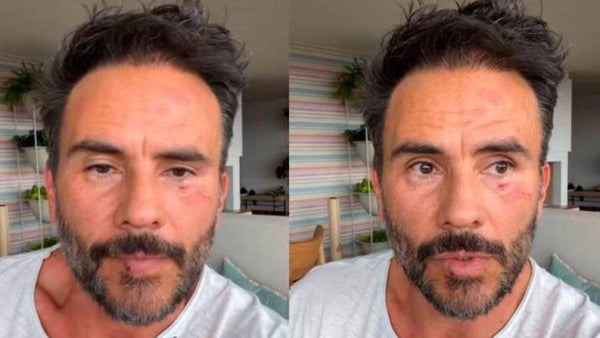 Capturadas ocho personas vinculadas al robo a Juan Pablo Raba en cerros de Bogotá