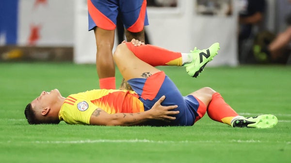 Copa América: James dice que es mejor ganar y corregir cosas