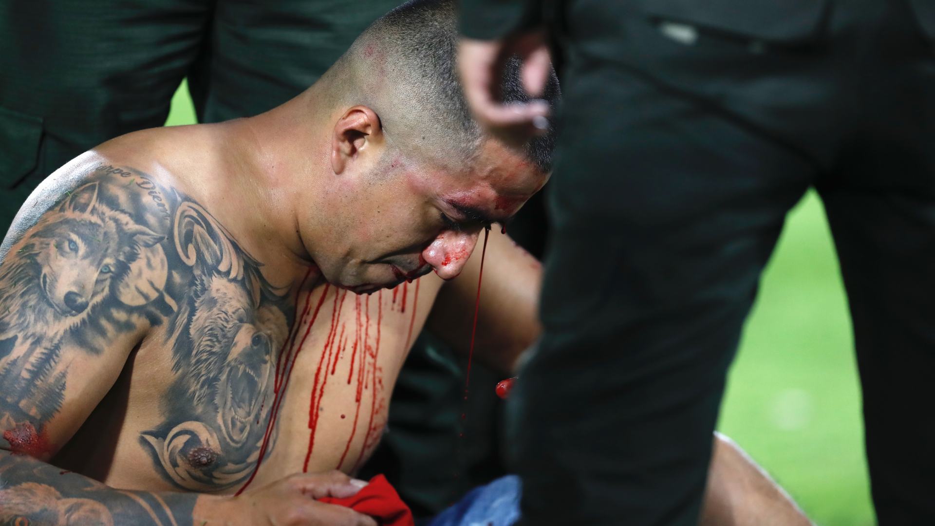 Futbolo colombiano//Atletico Nacional// America de Cali// Estadio Pascual Gurrero//desmanes//Policia//Copa Colombia//Revista Alternativa