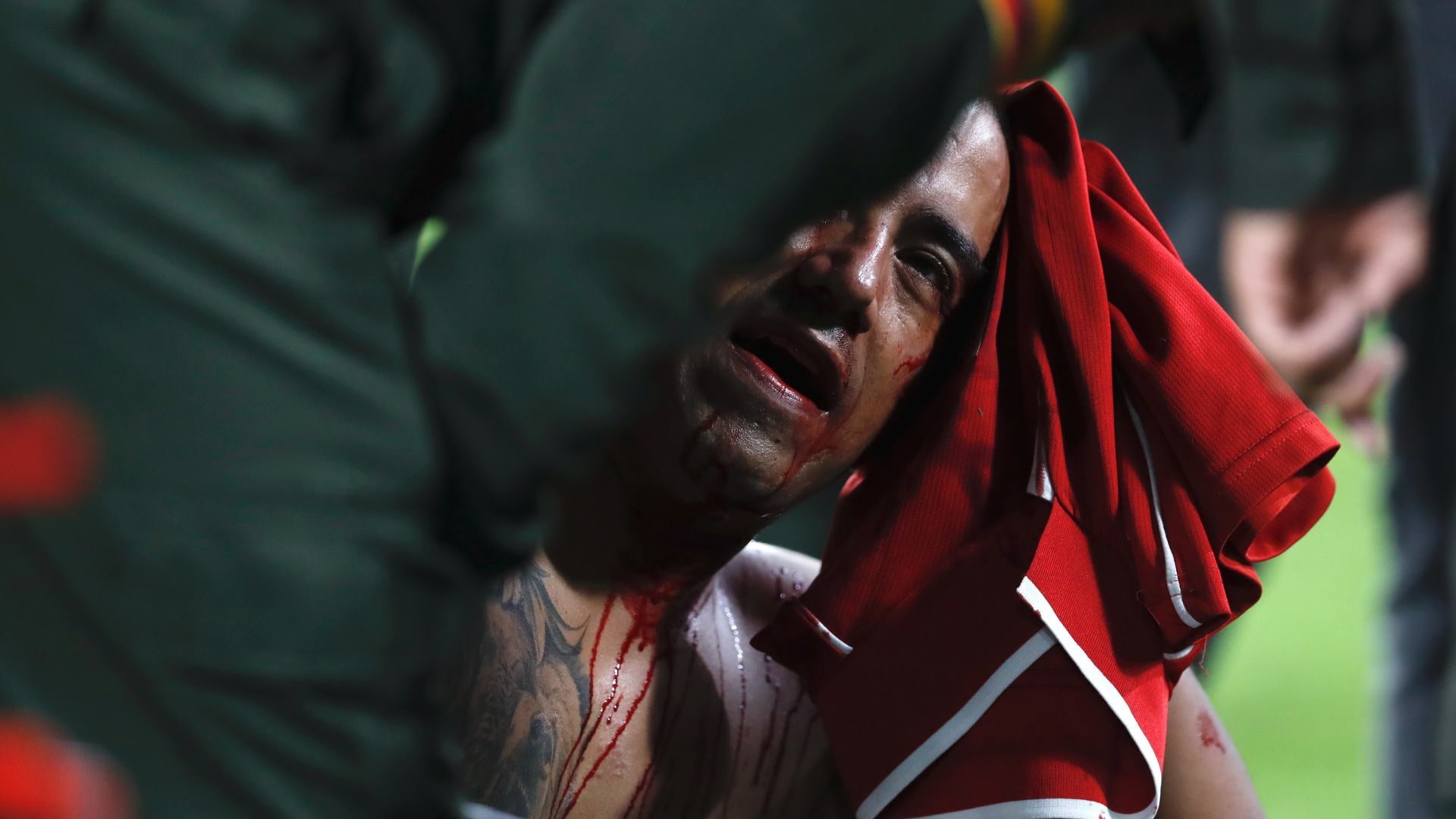 Futbolo colombiano//Atletico Nacional// America de Cali// Estadio Pascual Gurrero//desmanes//Policia//Copa Colombia//Revista Alternativa