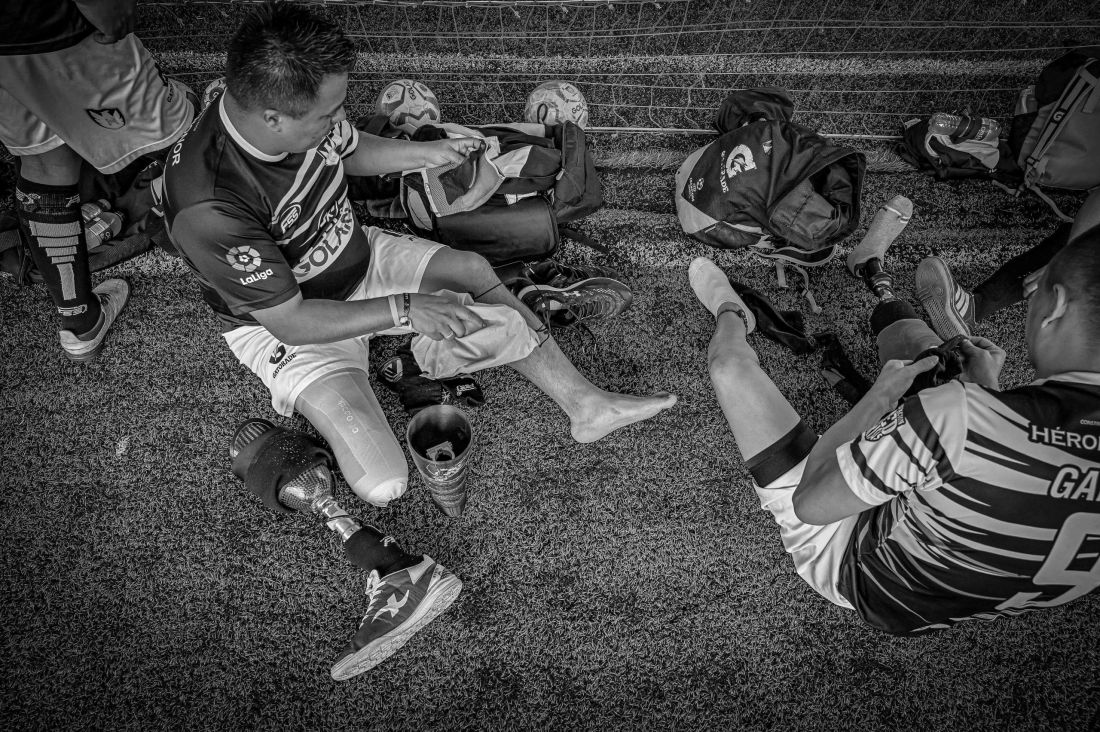 Muchos de ellos murieron en esa guerra de más de medio siglo en Colombia. Otros sobrevivieron con heridas que dejaron huella en sus cuerpos para siempre.